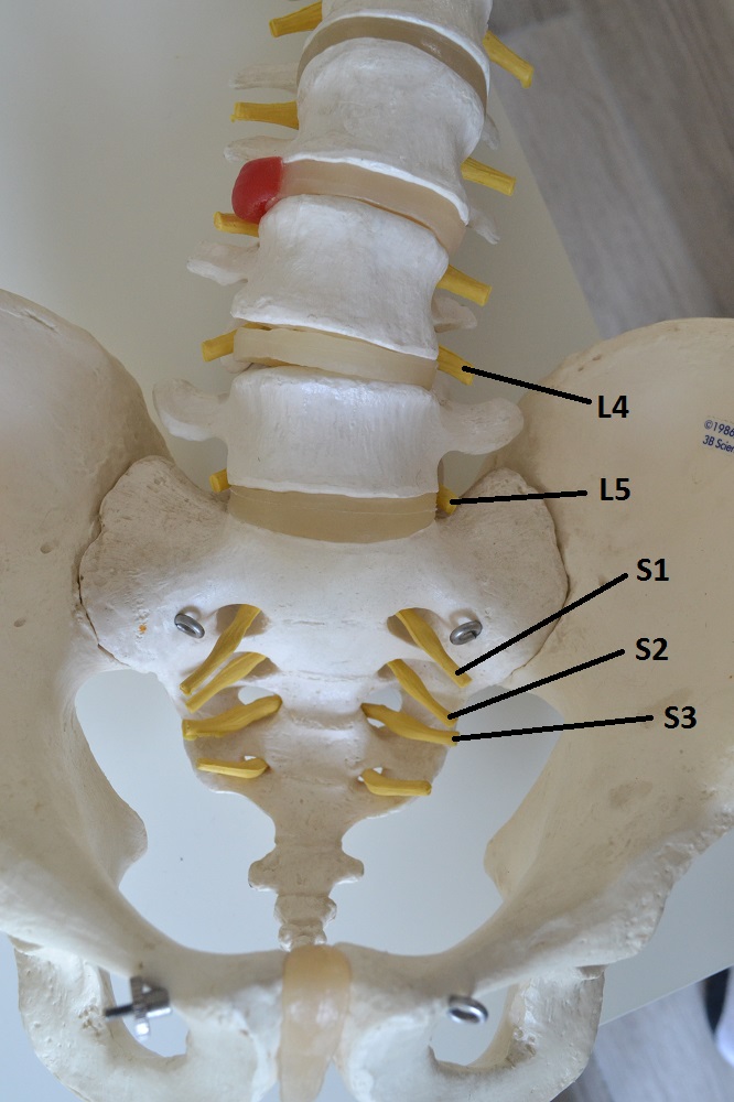 Herniated Disc L5/S1 - Symptoms and Treatment (2020 ... the human spine diagram 